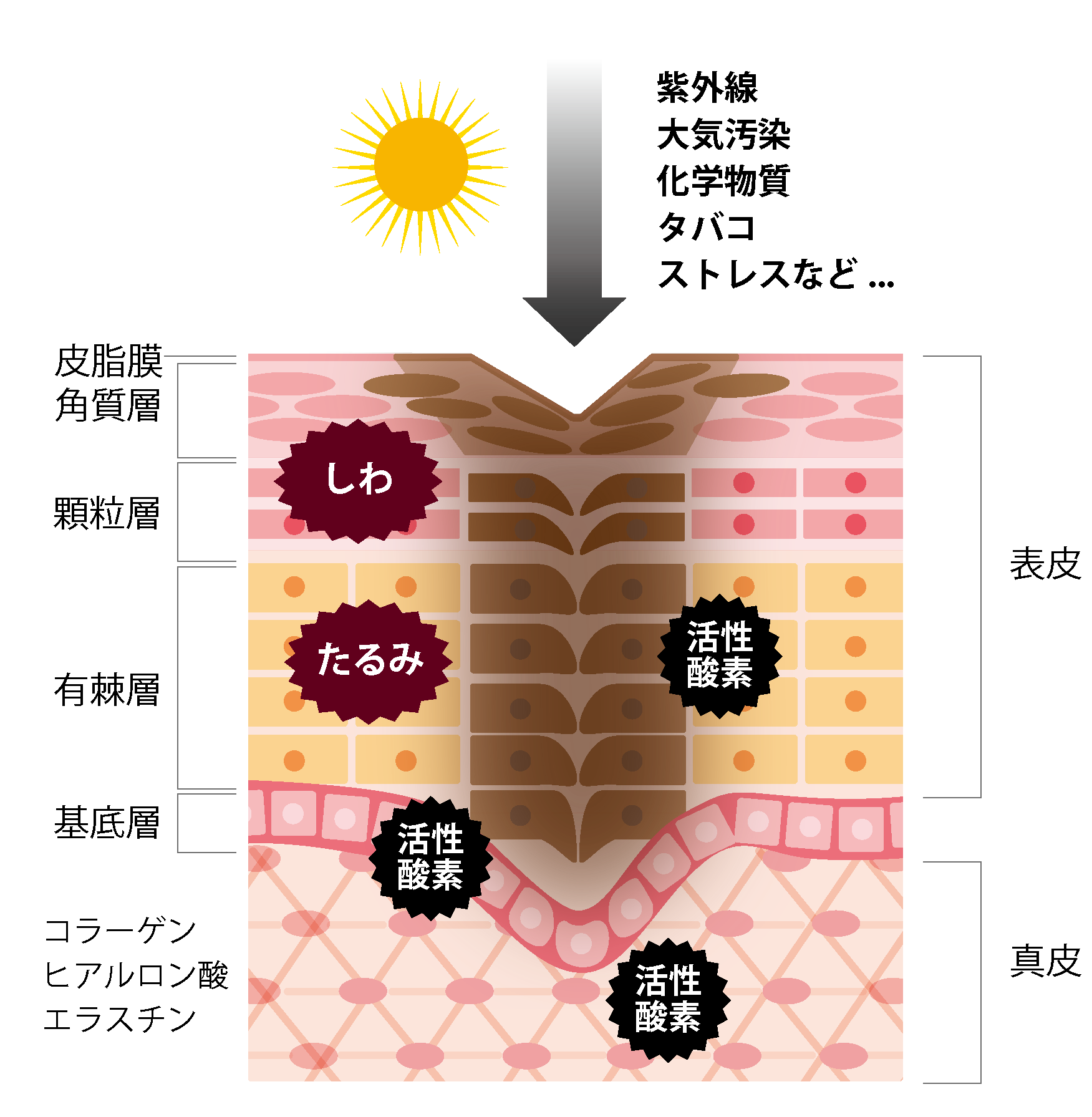 しわたるみ_肌構造